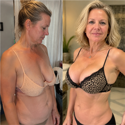 Alcuras®Targeted Breast & Buttock Enhancement Advanced Nano Microneedle Patch