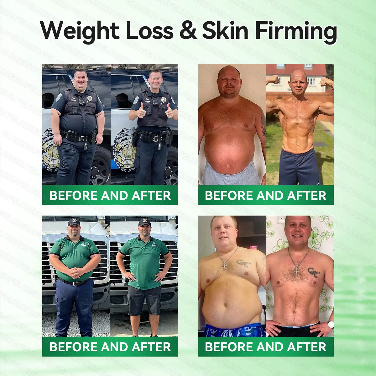 Umex® Metabolic Nano Microneedle Patchus (Just once a day, visible changes in 7 days) Berberine+ Moringa Formula  For obesity, Looseskin,diabetes, sleep apnea, joint issues, and more