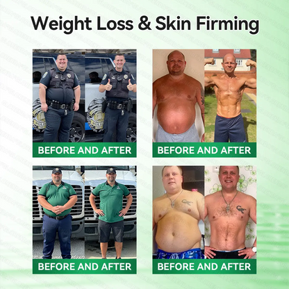 Umex® Metabolic Nano Microneedle Patchus (Just once a day, visible changes in 7 days) Berberine+ Moringa Formula  For obesity, Looseskin,diabetes, sleep apnea, joint issues, and more